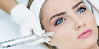 formation-MICRONEEDLING