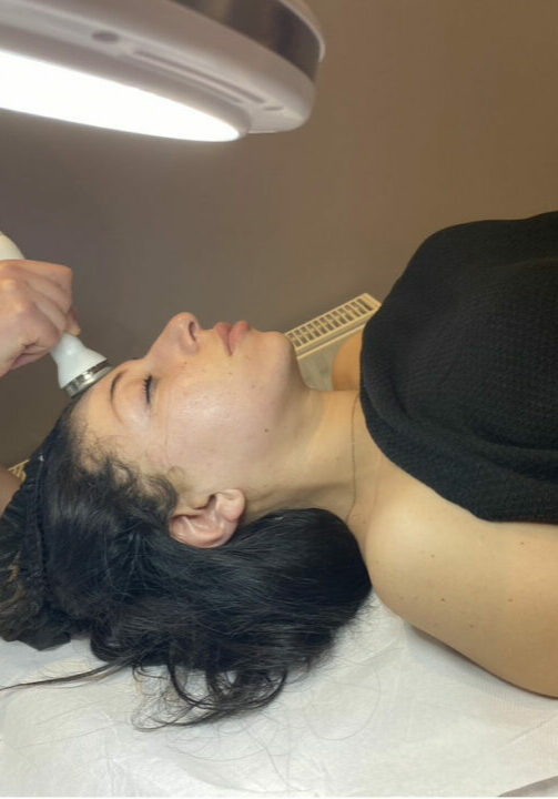 epilation1 epilation1