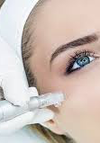 formation-MICRONEEDLING